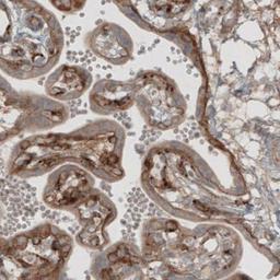 Immunohistochemistry: Laminin beta 1 Antibody (CL2970) [NBP2-42385] - Staining of human placenta shows moderate immunoreactivity in basement membrane of trophoblast and in endothelium.