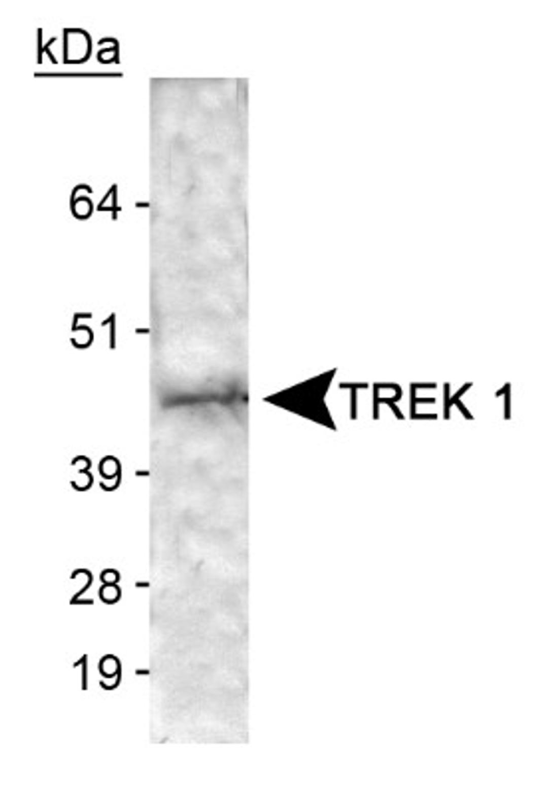 Western Blot: TREK 1 Antibody [NB110-41535] - Detection of TREK 1 in membrane lysate fraction of human brain tissue.