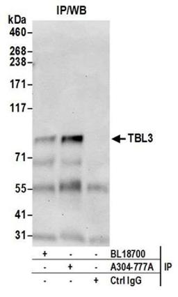 Detection of human TBL3 by western blot of immunoprecipitates.