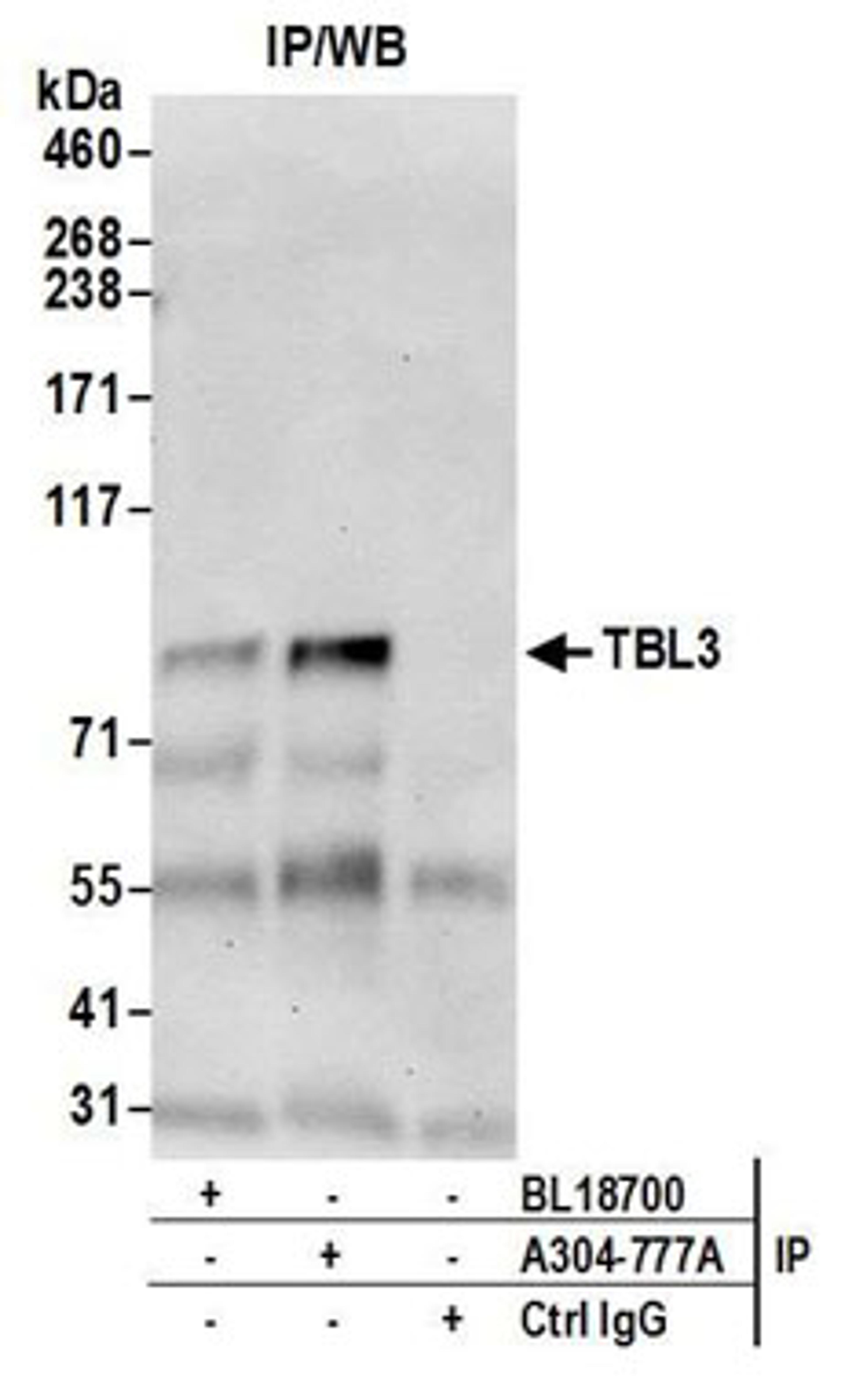 Detection of human TBL3 by western blot of immunoprecipitates.