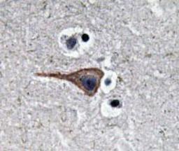 Immunohistochemistry: EGF Antibody [NBP1-19806] - Human brain tissue.