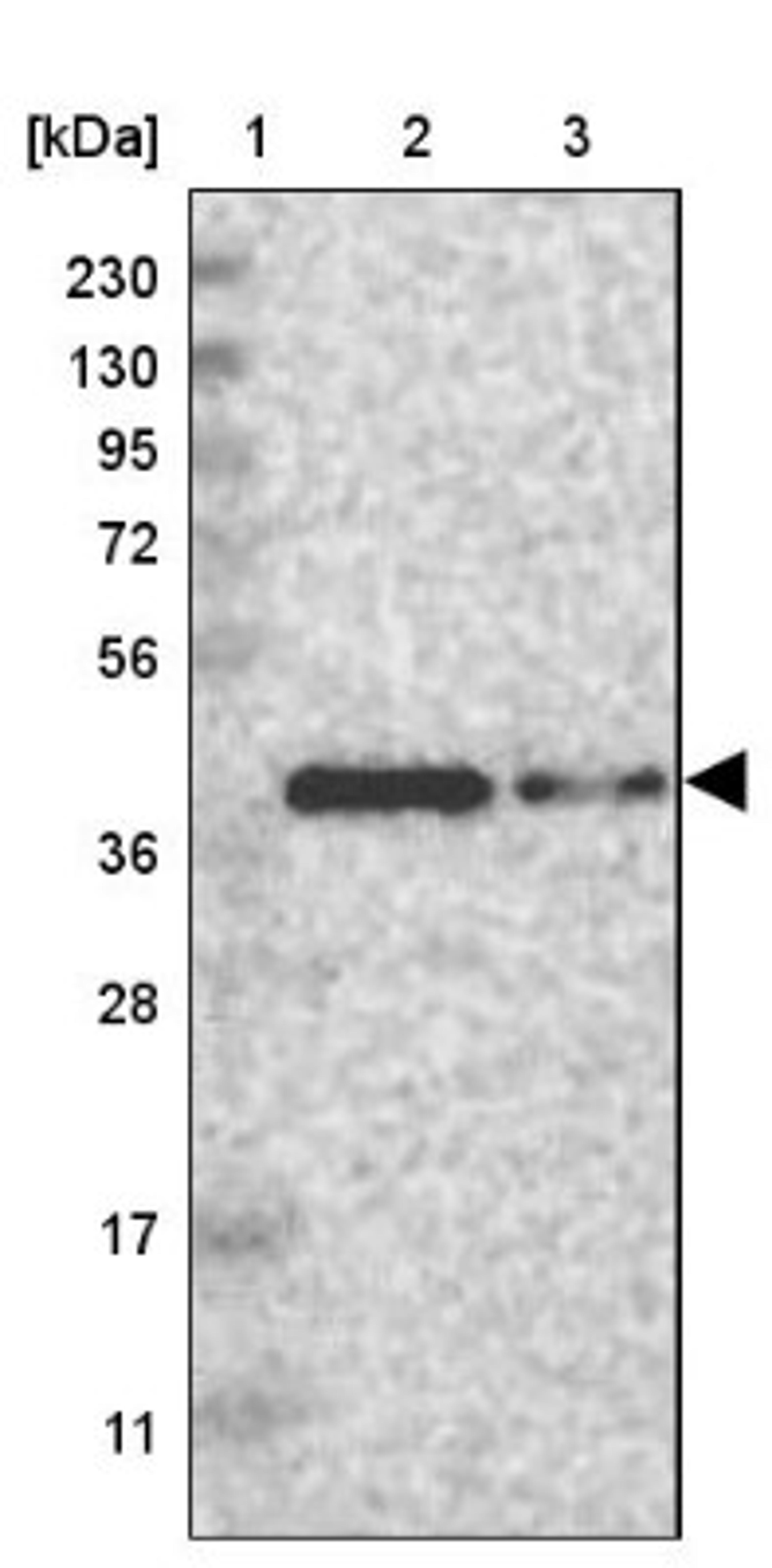 Western Blot: PHLDA1 Antibody [NBP1-84969] - Lane 1: Marker [kDa] 230, 130, 95, 72, 56, 36, 28, 17, 11<br/>Lane 2: Human cell line RT-4<br/>Lane 3: Human cell line U-251MG sp