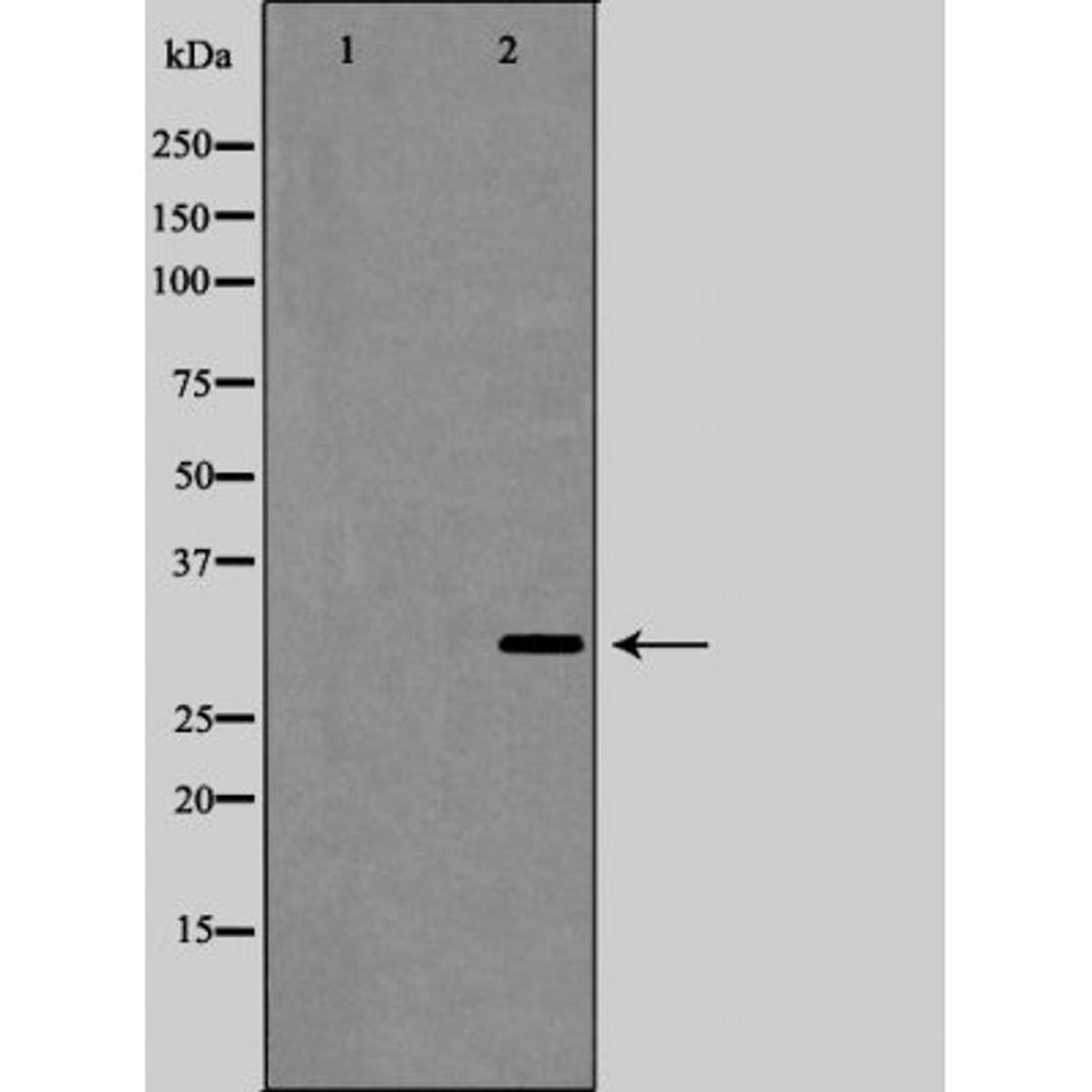 Western blot analysis of Hela cell lysate using Interleukin 1beta antibody