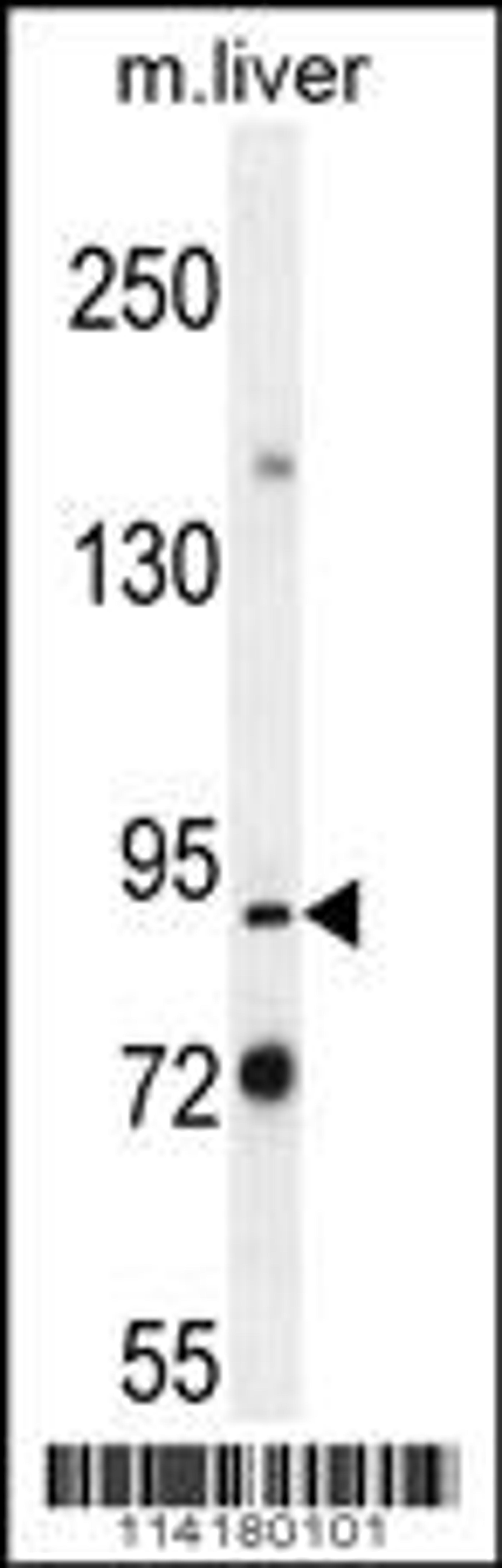 Western blot analysis in mouse liver tissue lysates (35ug/lane).