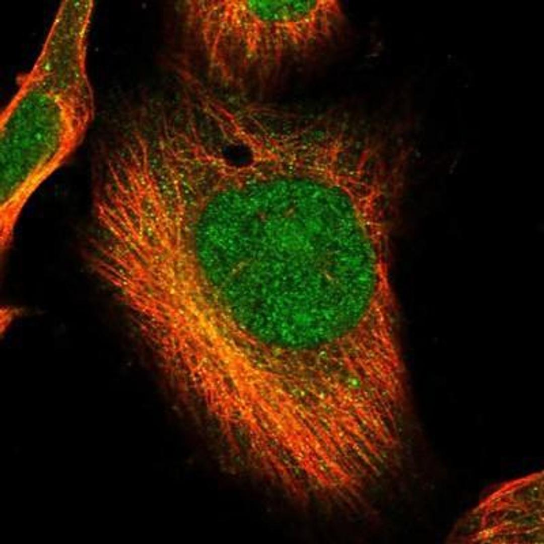 Immunocytochemistry/Immunofluorescence: CDC2L1 Antibody [NBP1-85726] - Staining of human cell line U-251MG shows positivity in nucleus & cytoplasm.