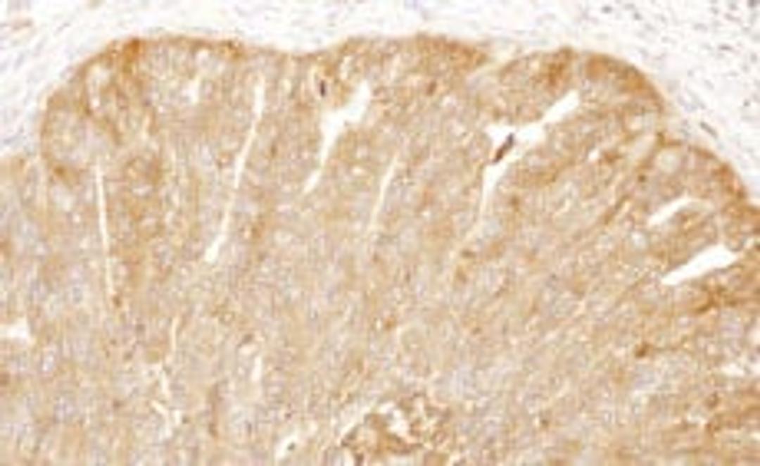 Detection of human CAP1 by immunohistochemistry.