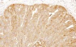 Detection of human CAP1 by immunohistochemistry.