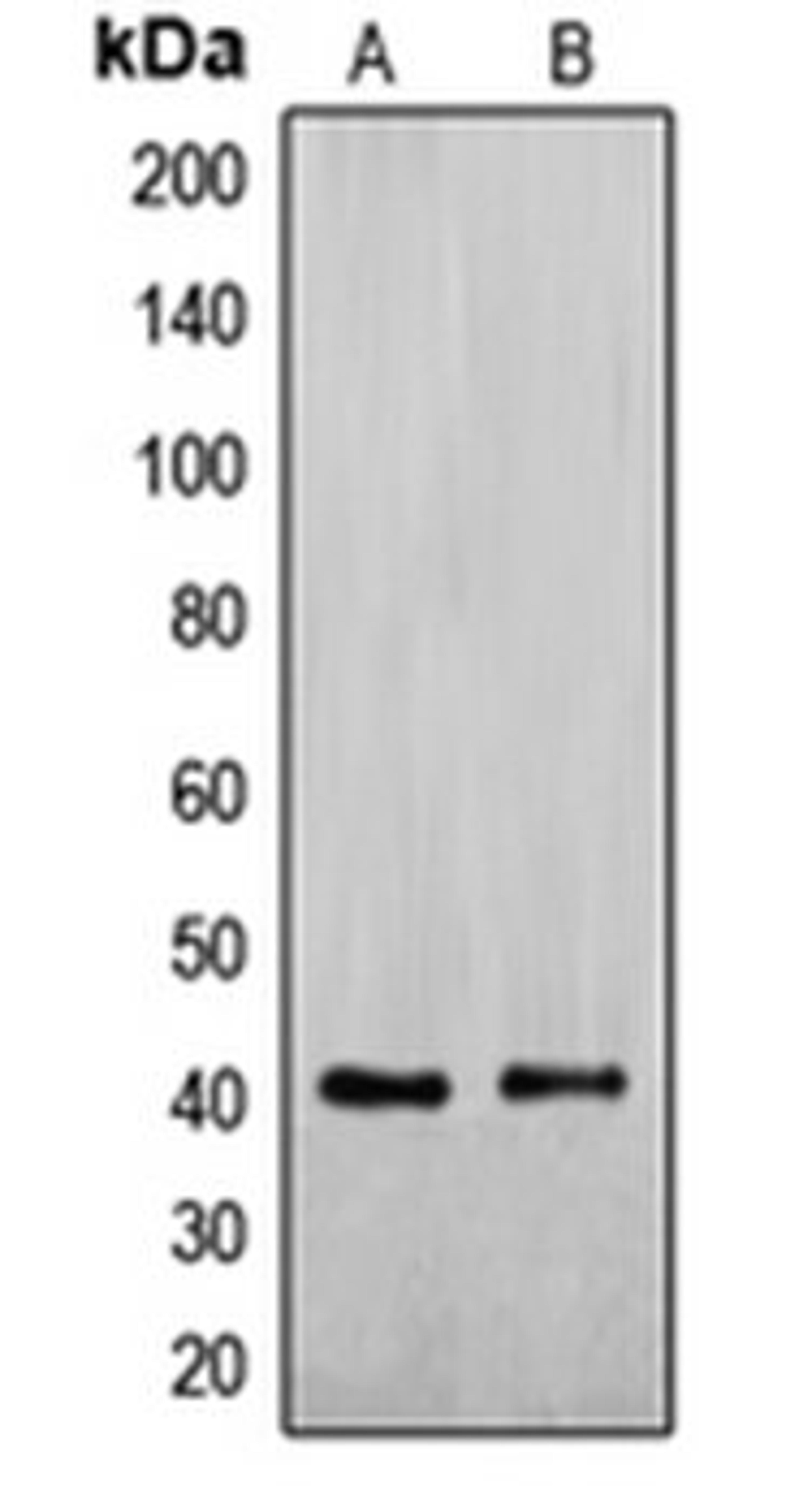 Western blot analysis of Jurkat (Lane 1), HepG2 (Lane 2) whole cell lysates using EXOG antibody