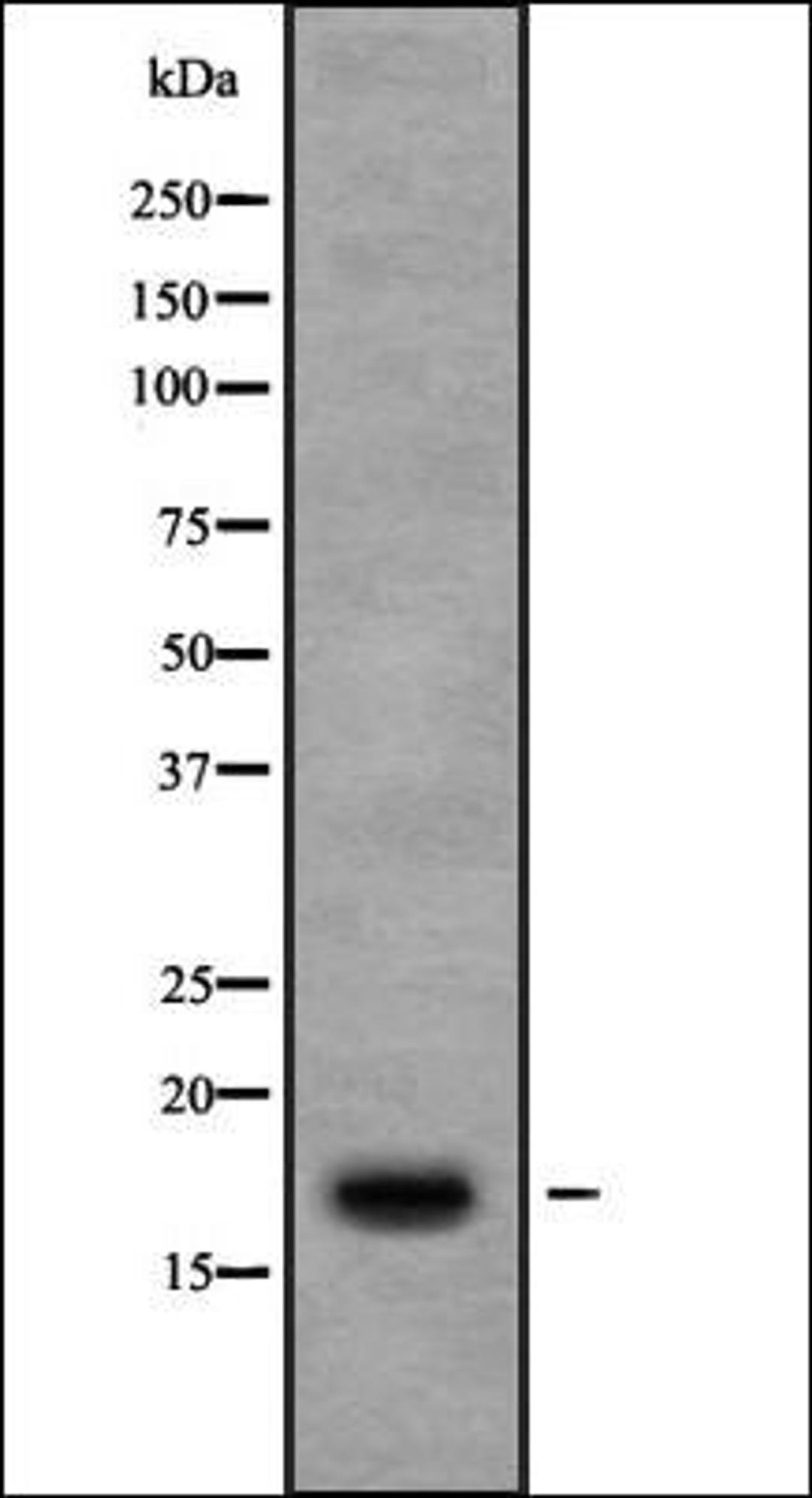 Western blot analysis of 3T3 whole cell lysates using Ribosomal Protein S13 antibody