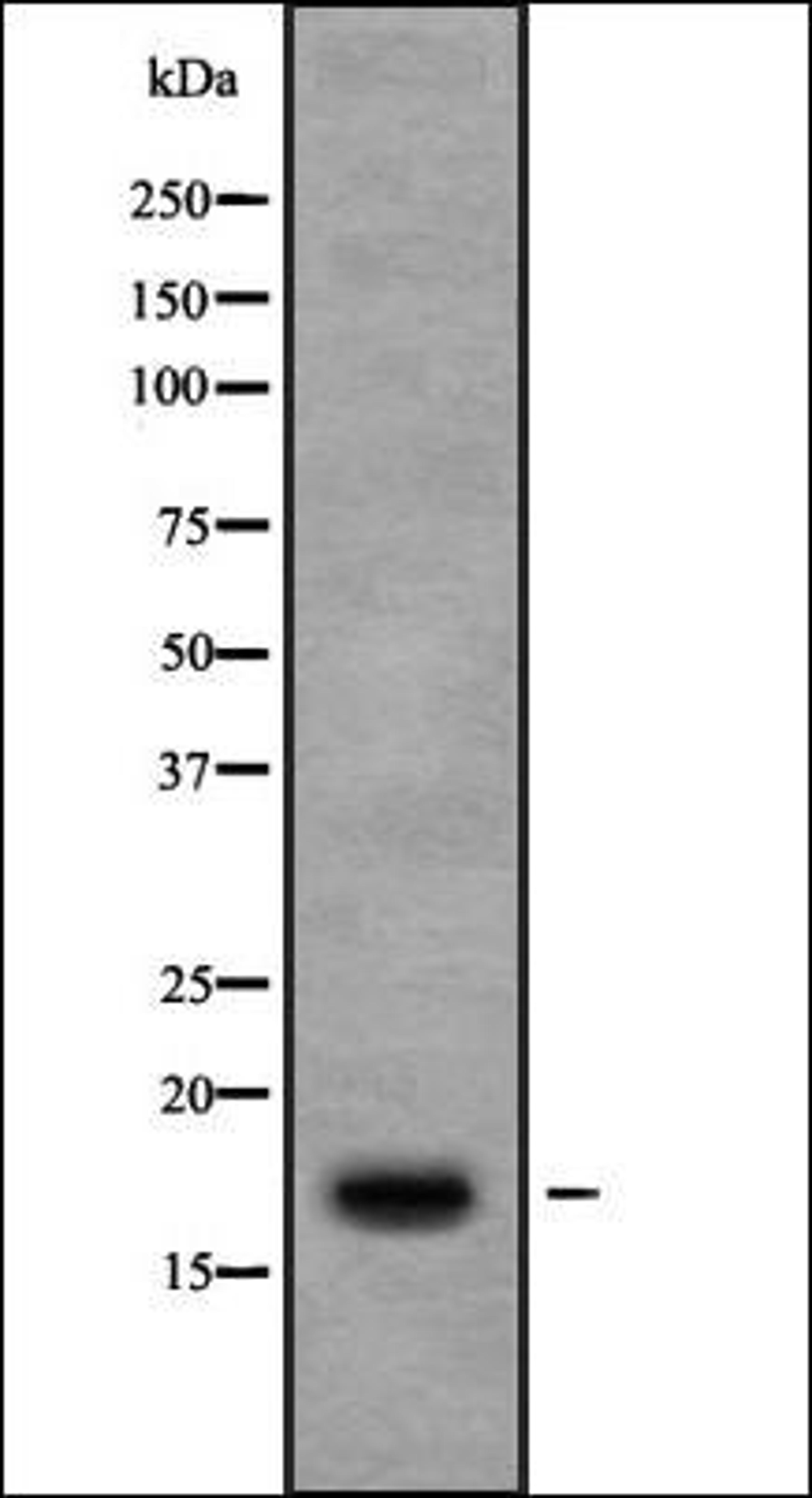 Western blot analysis of 3T3 whole cell lysates using Ribosomal Protein S13 antibody