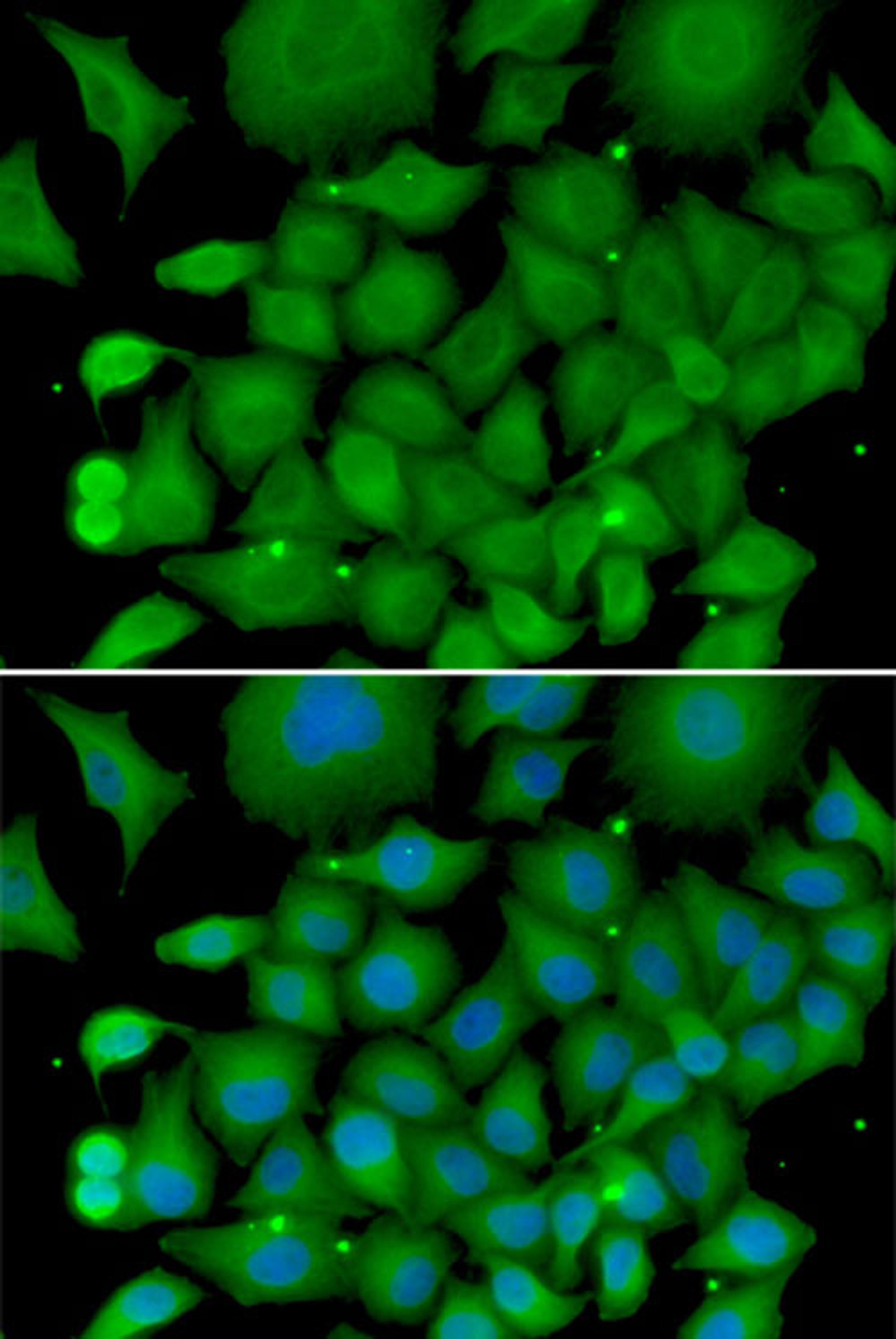 Immunofluorescence - SOD3 antibody (A13935)