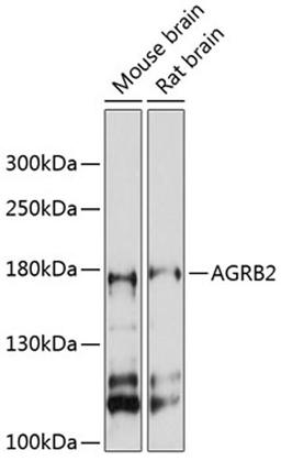 Western blot - AGRB2 antibody (A12380)