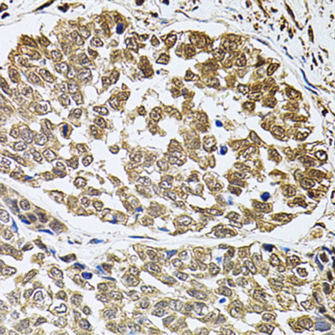 Immunohistochemistry - FOS antibody (A2444)