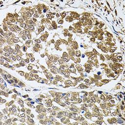 Immunohistochemistry - FOS antibody (A2444)