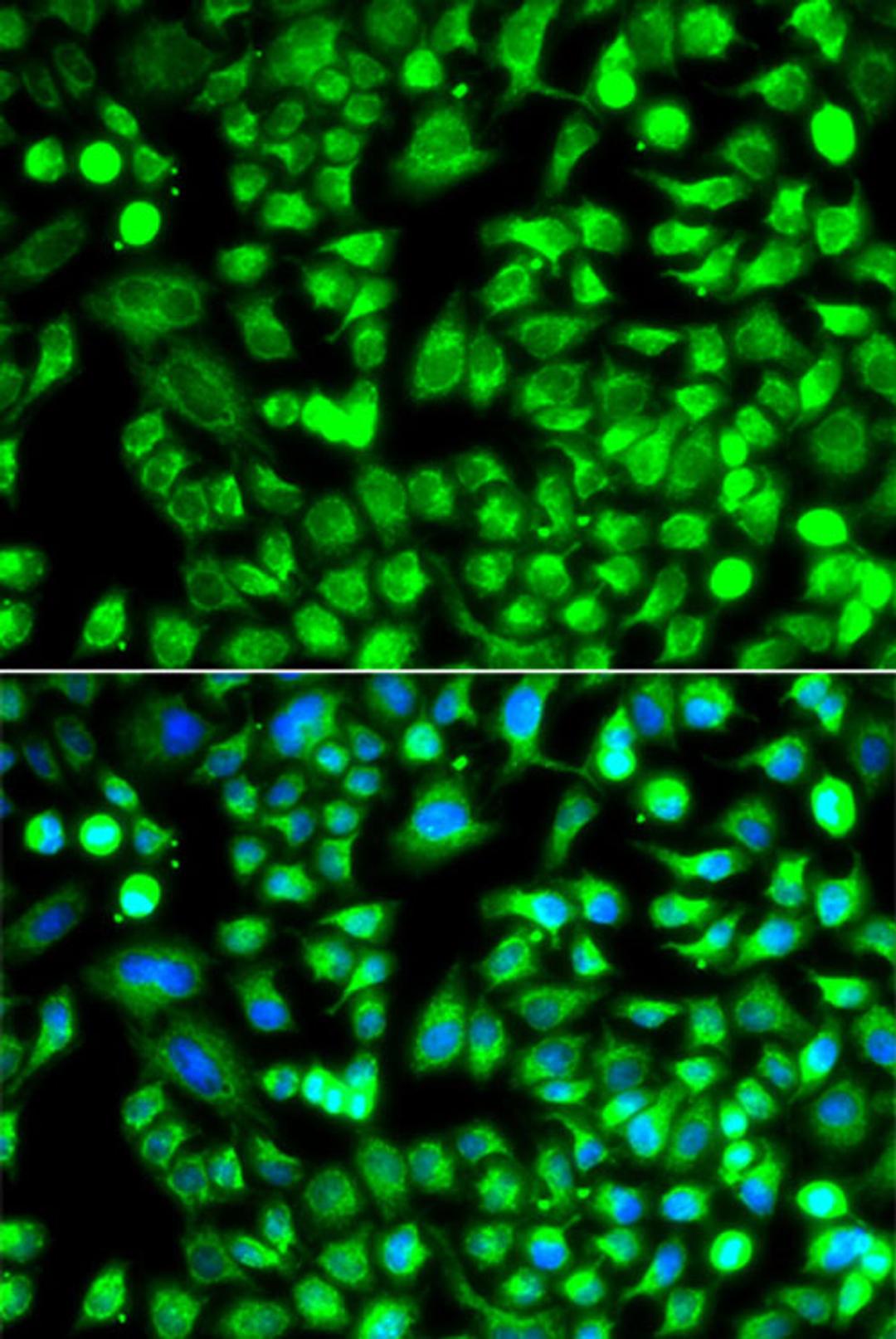 Immunofluorescence - ALKBH4 antibody (A12593)