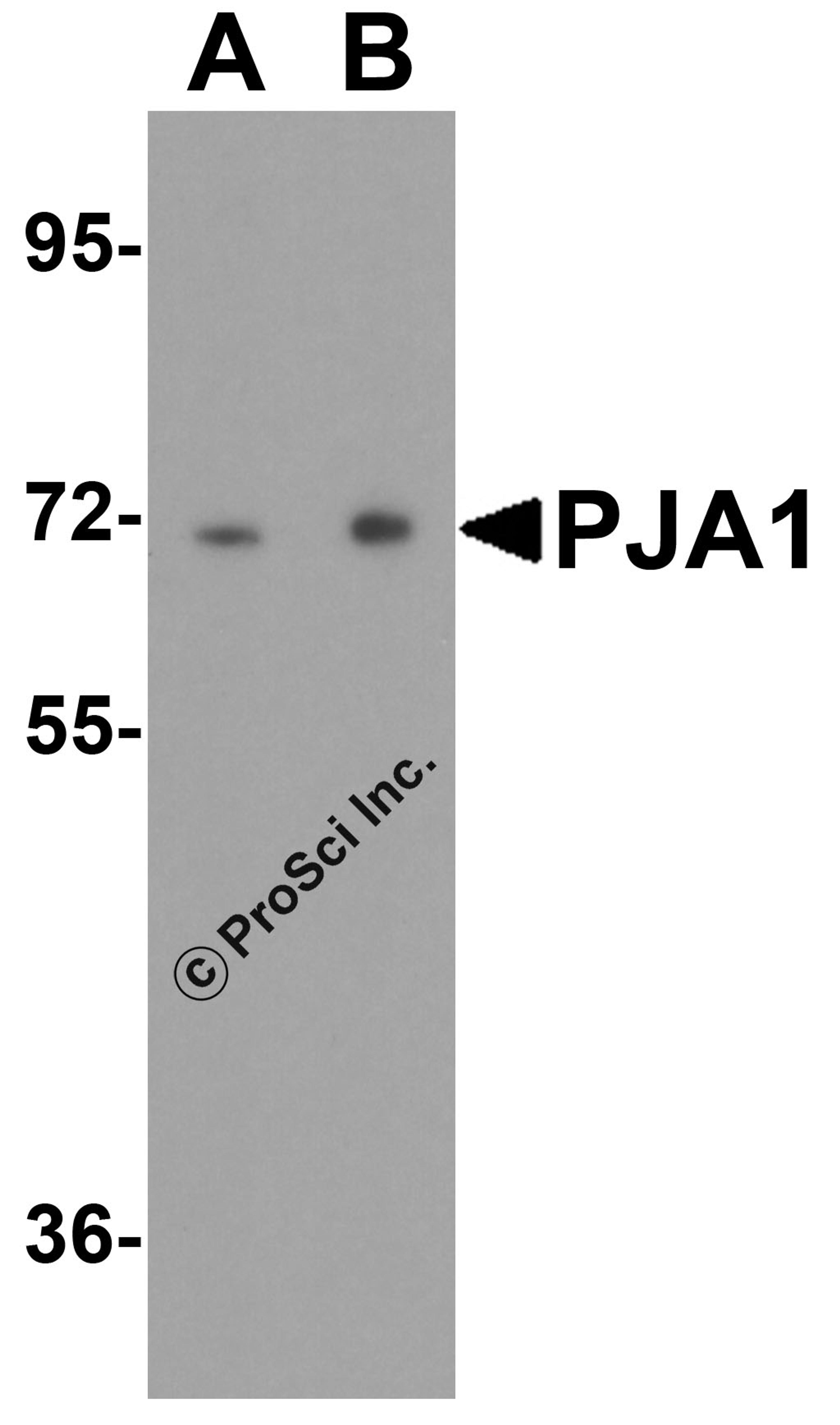 Western blot analysis of PJA1 in human brain tissue lysate with PJA1 antibody at (A) 0.25 and (B) 0.5 μg/ml.