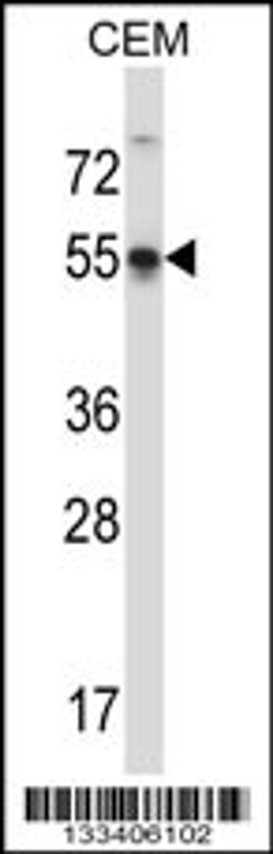 Western blot analysis in CEM cell line lysates (35ug/lane).