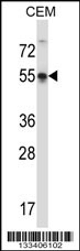 Western blot analysis in CEM cell line lysates (35ug/lane).