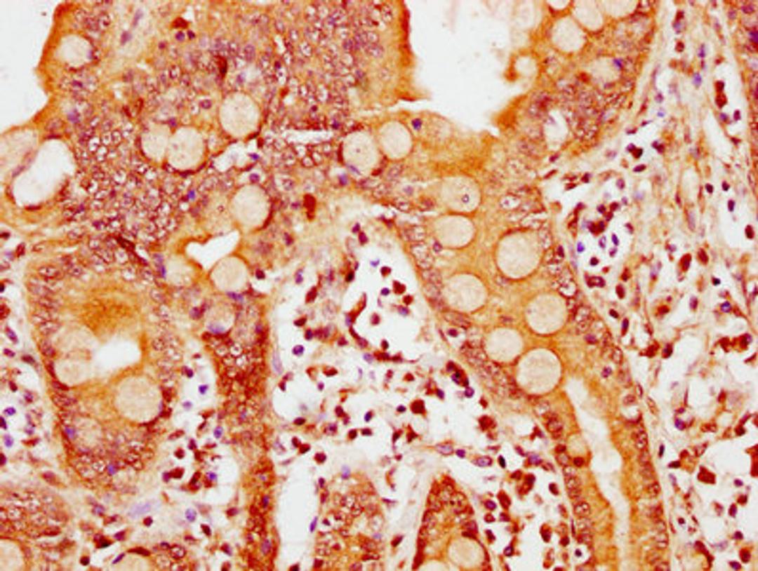 IHC image of CSB-PA818777LA01HU diluted at 1:600 and staining in paraffin-embedded human small intestine tissue performed on a Leica BondTM system. After dewaxing and hydration, antigen retrieval was mediated by high pressure in a citrate buffer (pH 6.0). Section was blocked with 10% normal goat serum 30min at RT. Then primary antibody (1% BSA) was incubated at 4&deg;C overnight. The primary is detected by a biotinylated secondary antibody and visualized using an HRP conjugated SP system.
