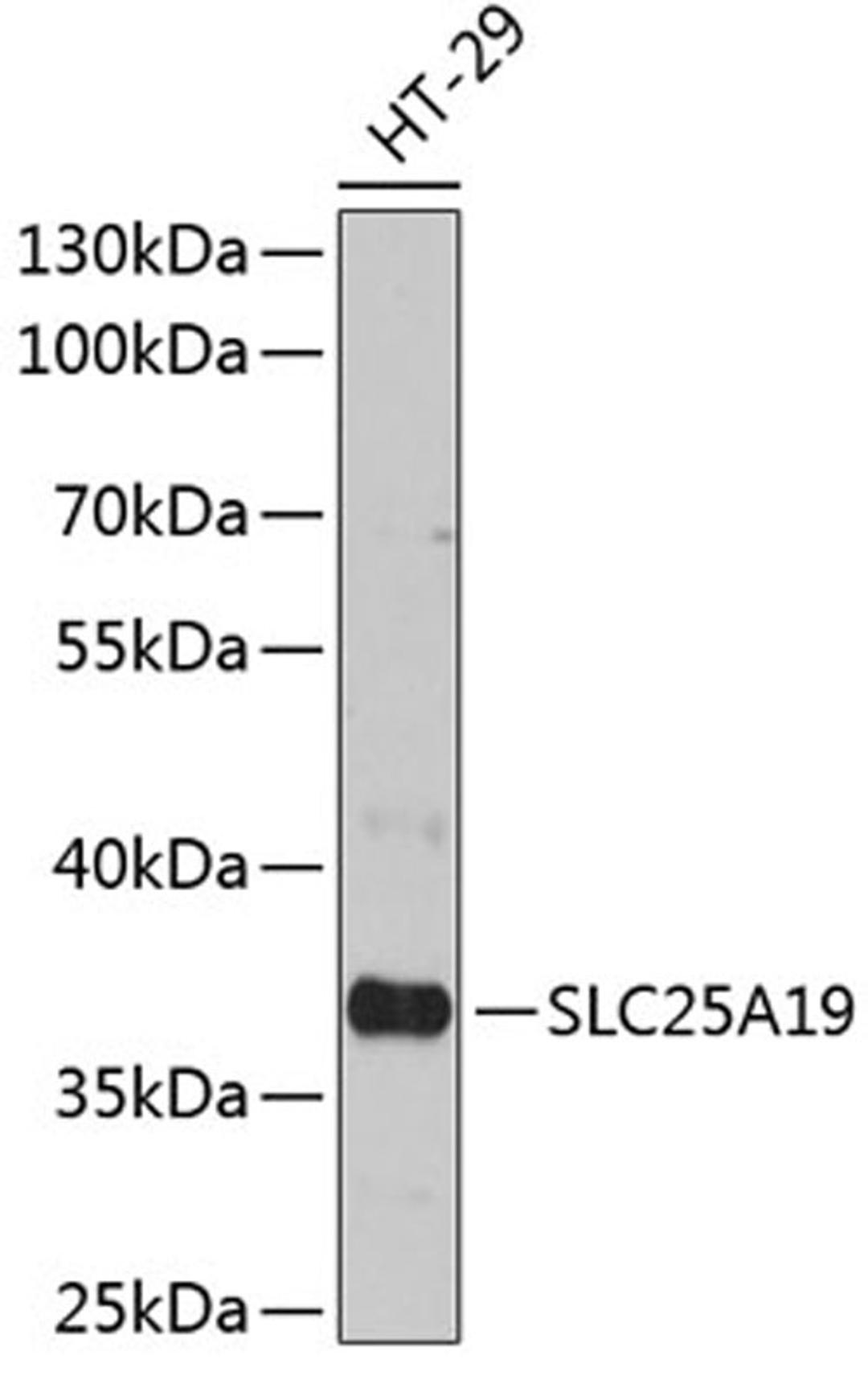 Western blot - SLC25A19 antibody (A12373)