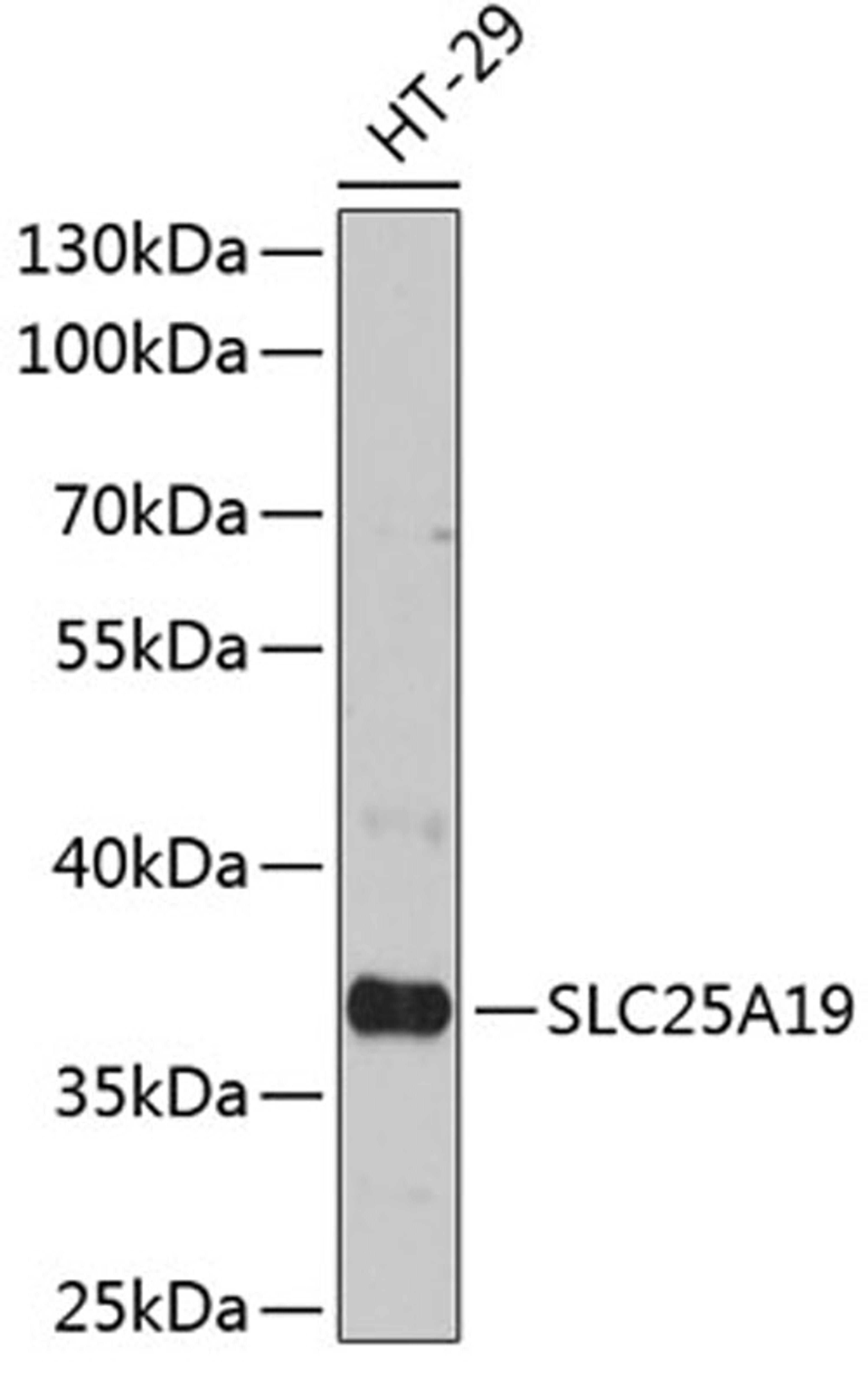 Western blot - SLC25A19 antibody (A12373)