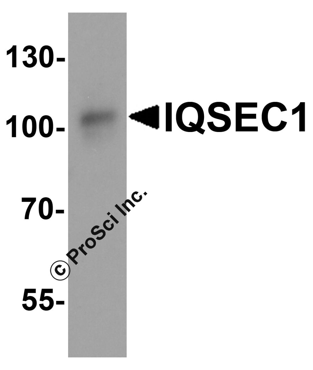 Western blot analysis of IQSEC1 in A20 cell lysate with IQSEC1 antibody at 1 μg/ml.