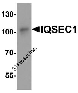 Western blot analysis of IQSEC1 in A20 cell lysate with IQSEC1 antibody at 1 μg/ml.