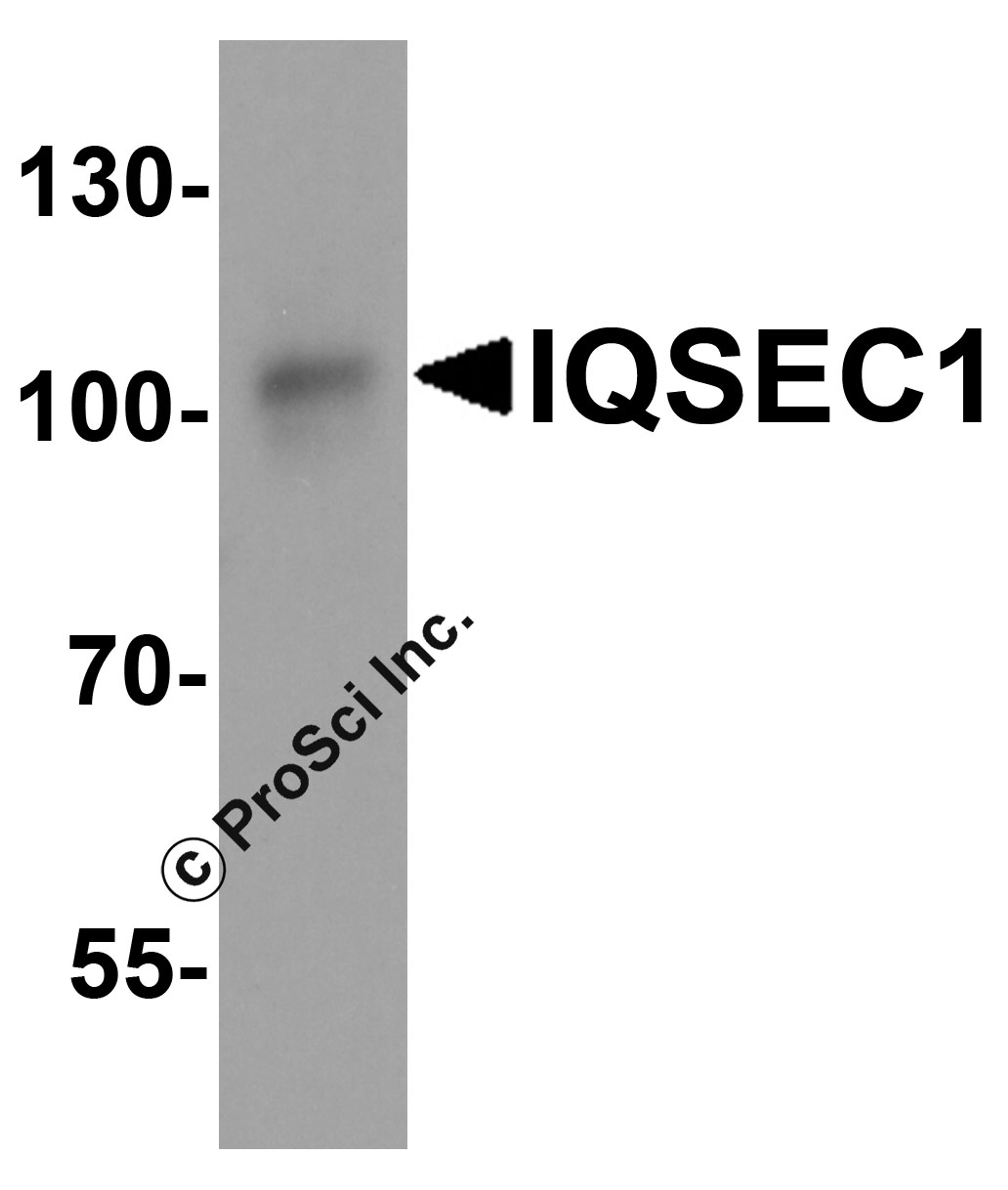 Western blot analysis of IQSEC1 in A20 cell lysate with IQSEC1 antibody at 1 μg/ml.