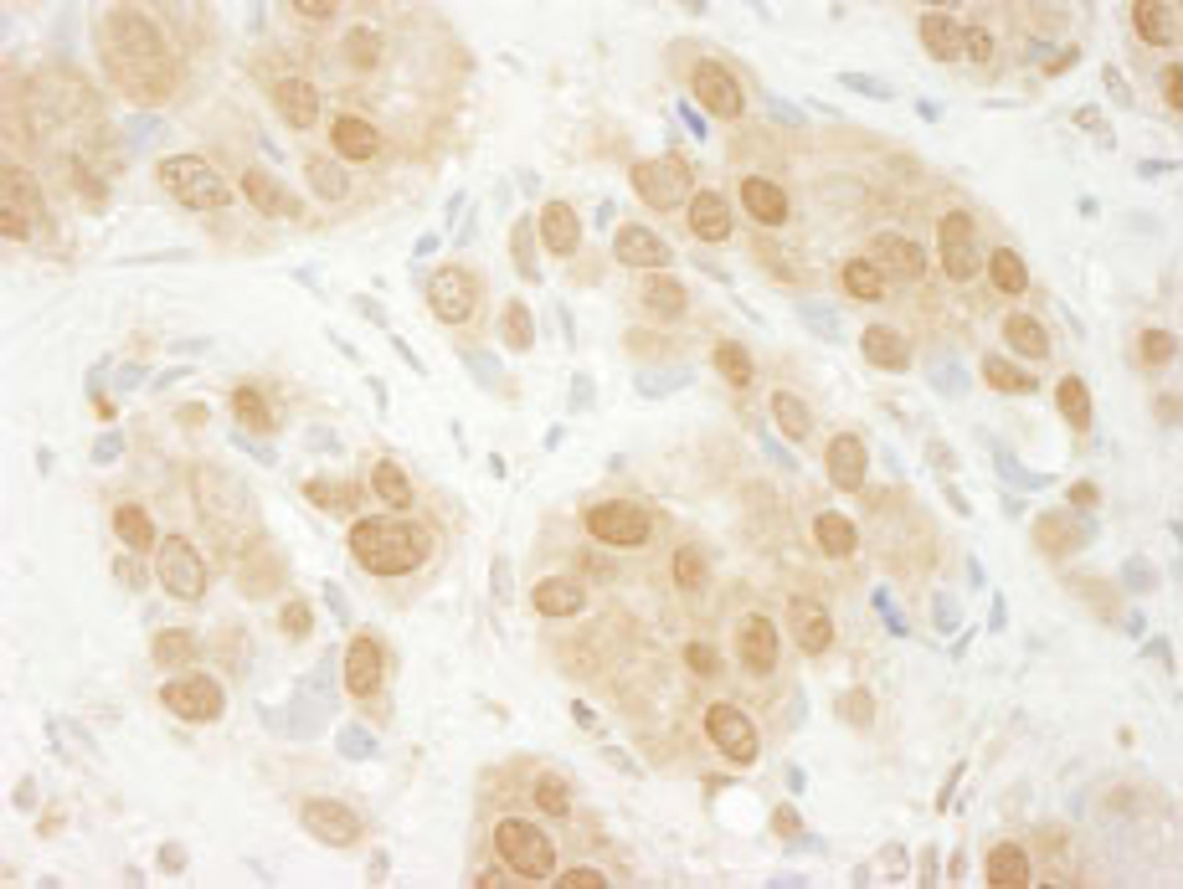 Detection of human ERK1 by immunohistochemistry.