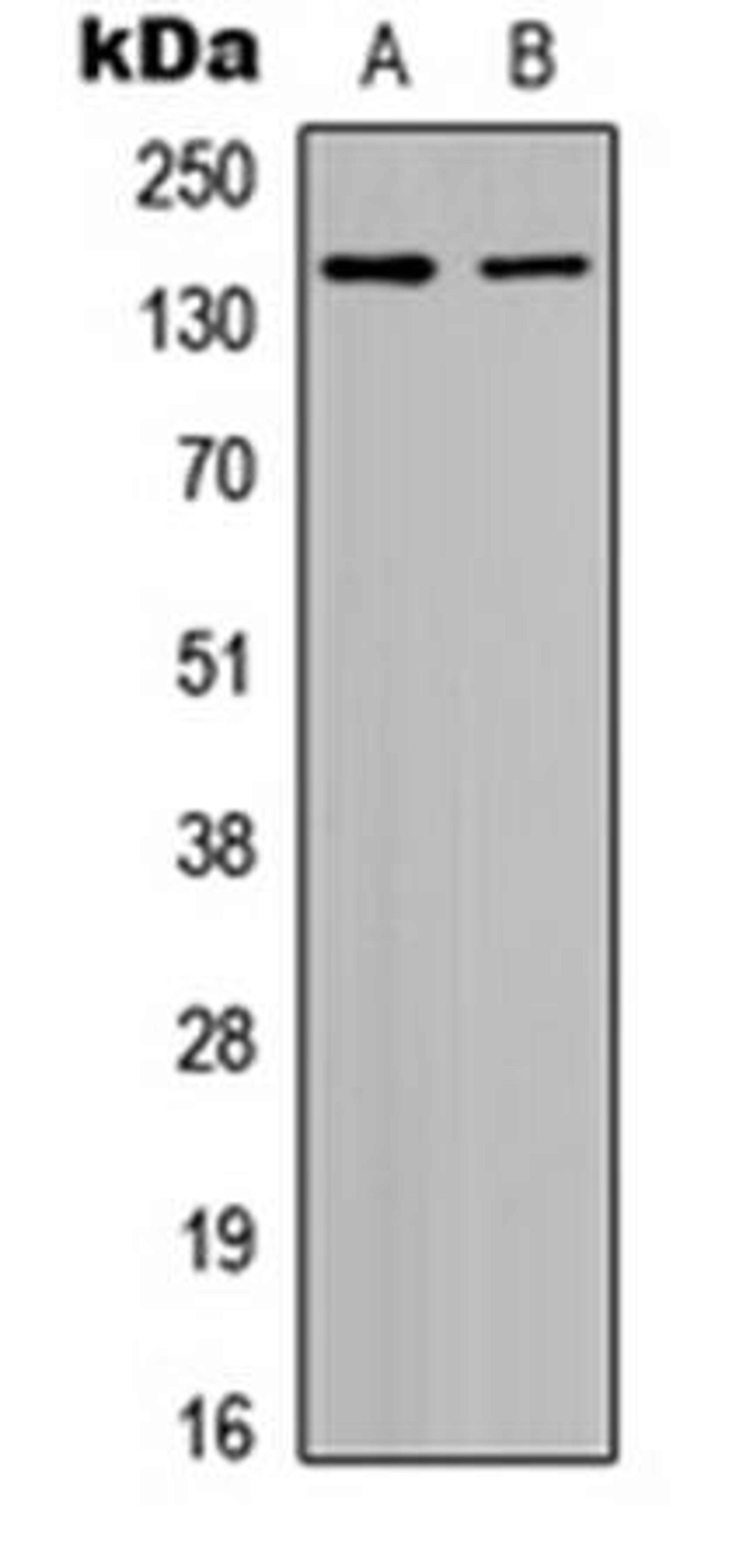 Western blot analysis of HepG2 (Lane1), HeLa (Lane2) whole cell using Histone Deacetylase 6 (phospho-S22) antibody