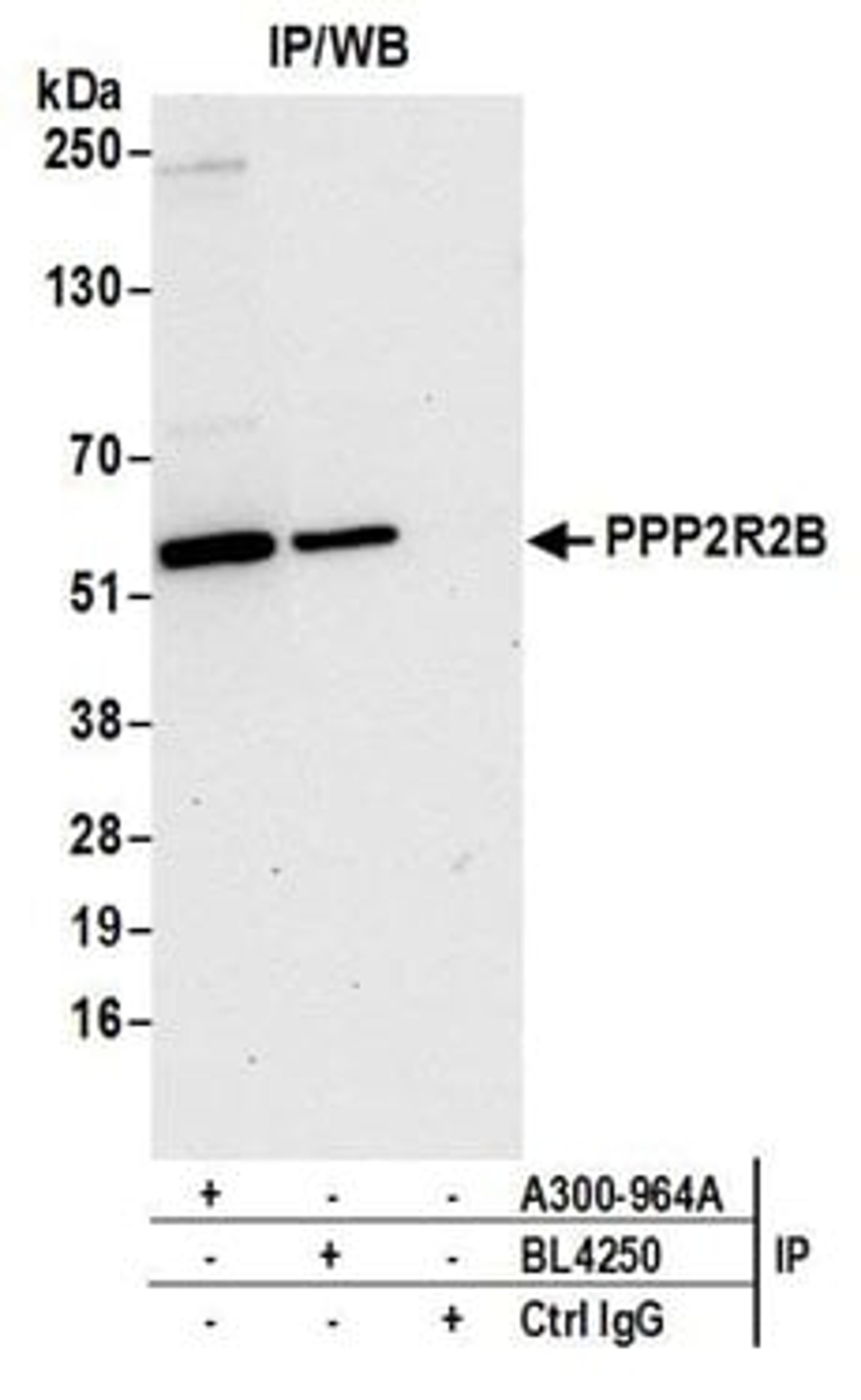 Detection of human PPP2R2B by western blot of immunoprecipitates.