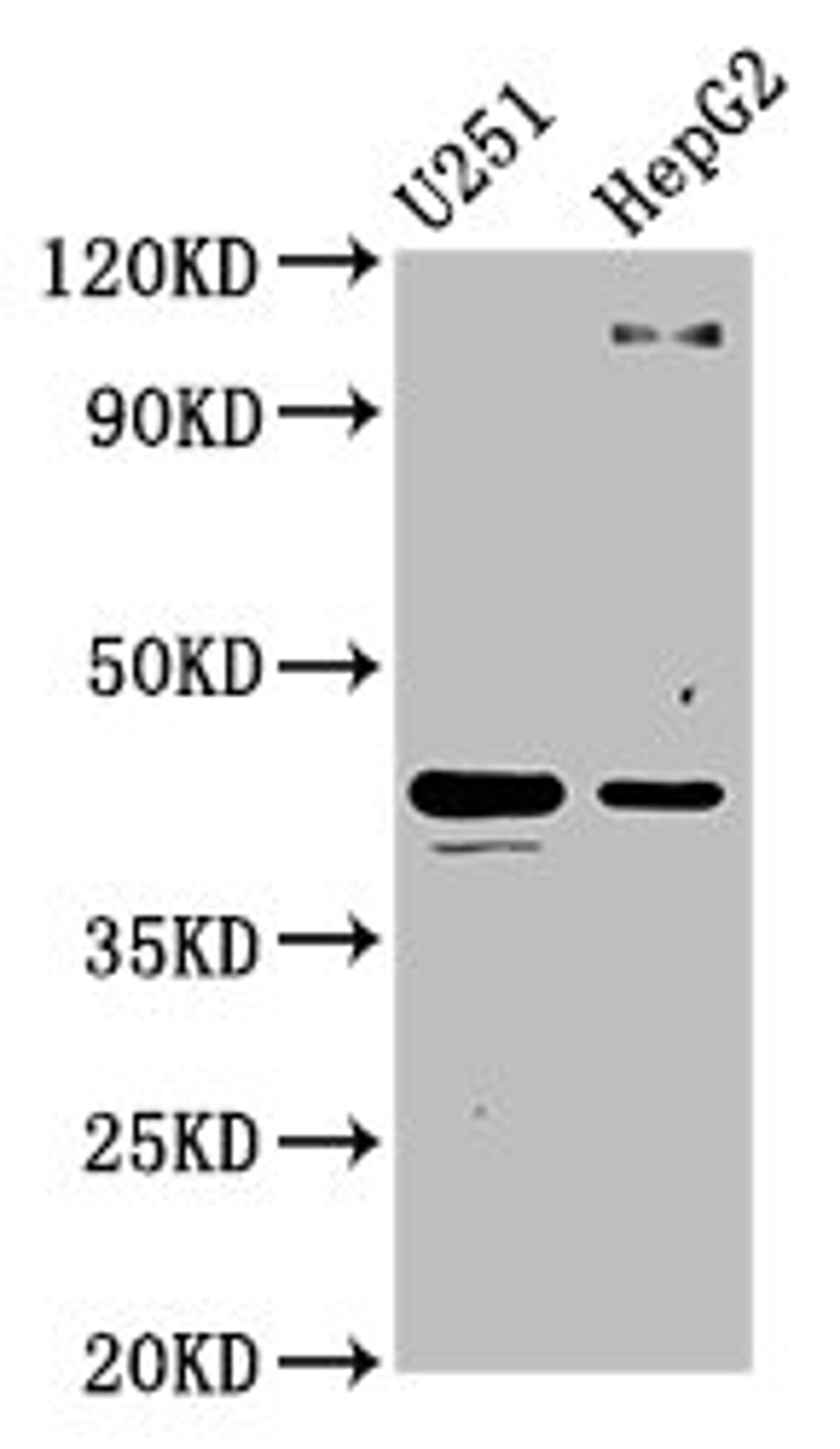 Western Blot. Positive WB detected in: U251 whole cell lysate, HepG2 whole cell lysate. All lanes: C1GALT1 antibody at 4.4µg/ml. Secondary. Goat polyclonal to rabbit IgG at 1/50000 dilution. Predicted band size: 43, 36 kDa. Observed band size: 43 kDa
