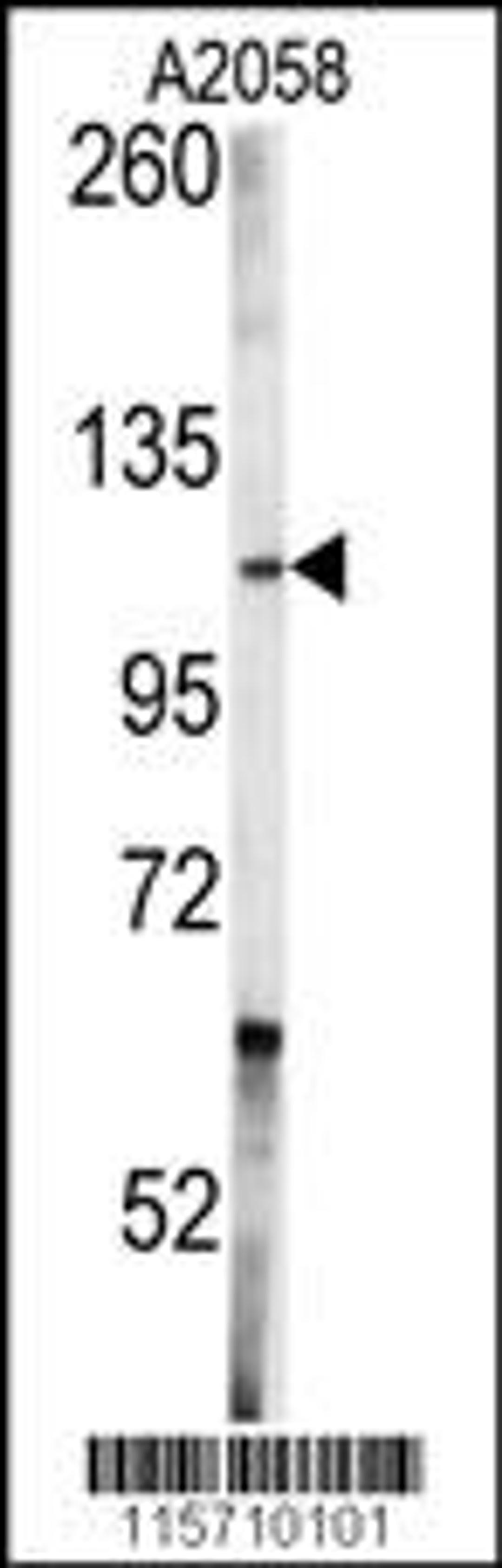 Western blot analysis of anti-ABL1 Antibody in A2058 cell line lysates (35ug/lane)