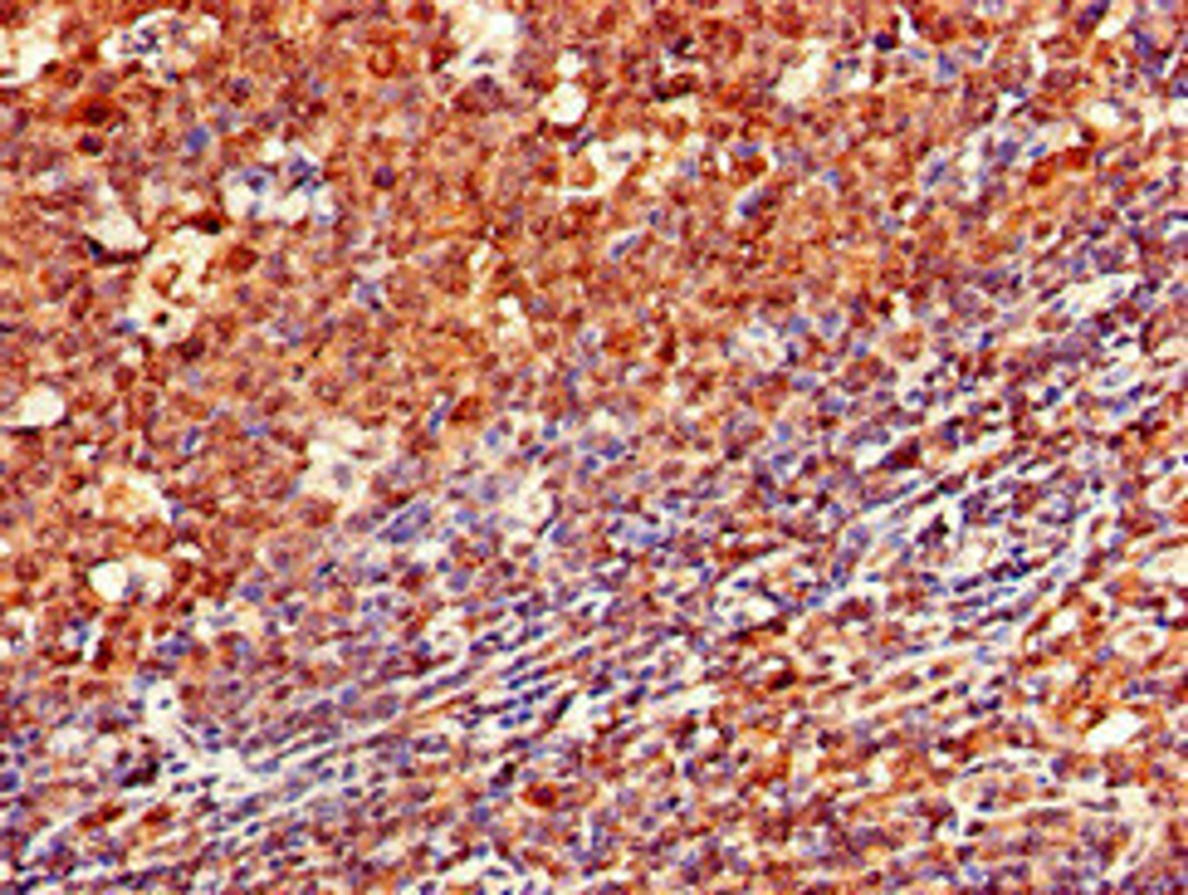 Immunohistochemistry of paraffin-embedded human tonsil tissue using CSB-PA004957LA01HU at dilution of 1:100