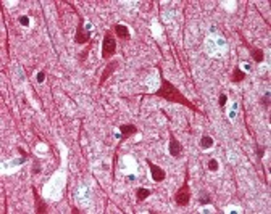 Immunohistochemistry staining of EIF2AK4 in brain cortex tissue using EIF2AK4 Antibody.