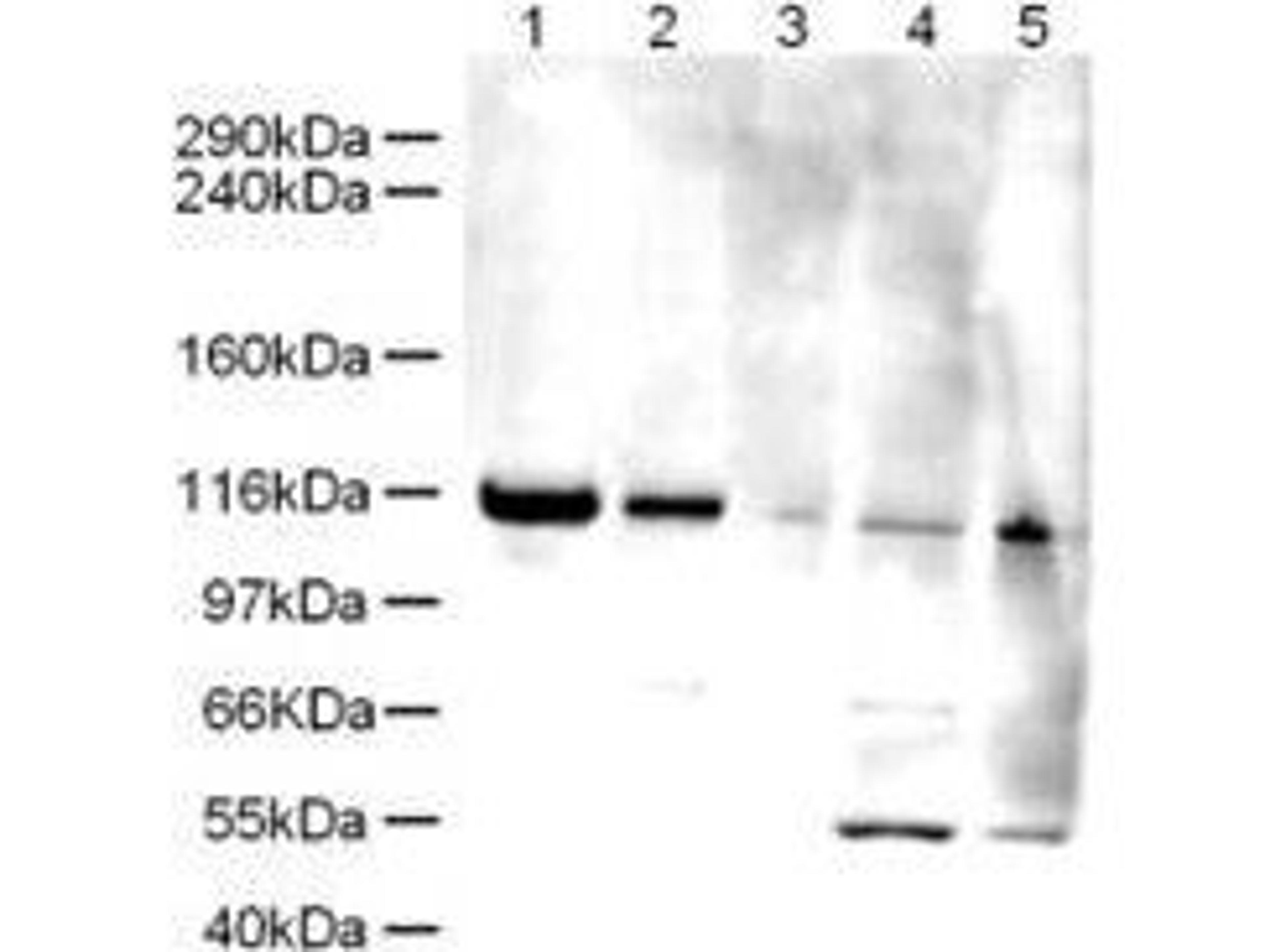 Western blot analysis of various cell lysates extract (1), HeLa (2), A431 (3), Jurkat (4) and HEK293 (5) whole cell lysates using ELG-1 antibody