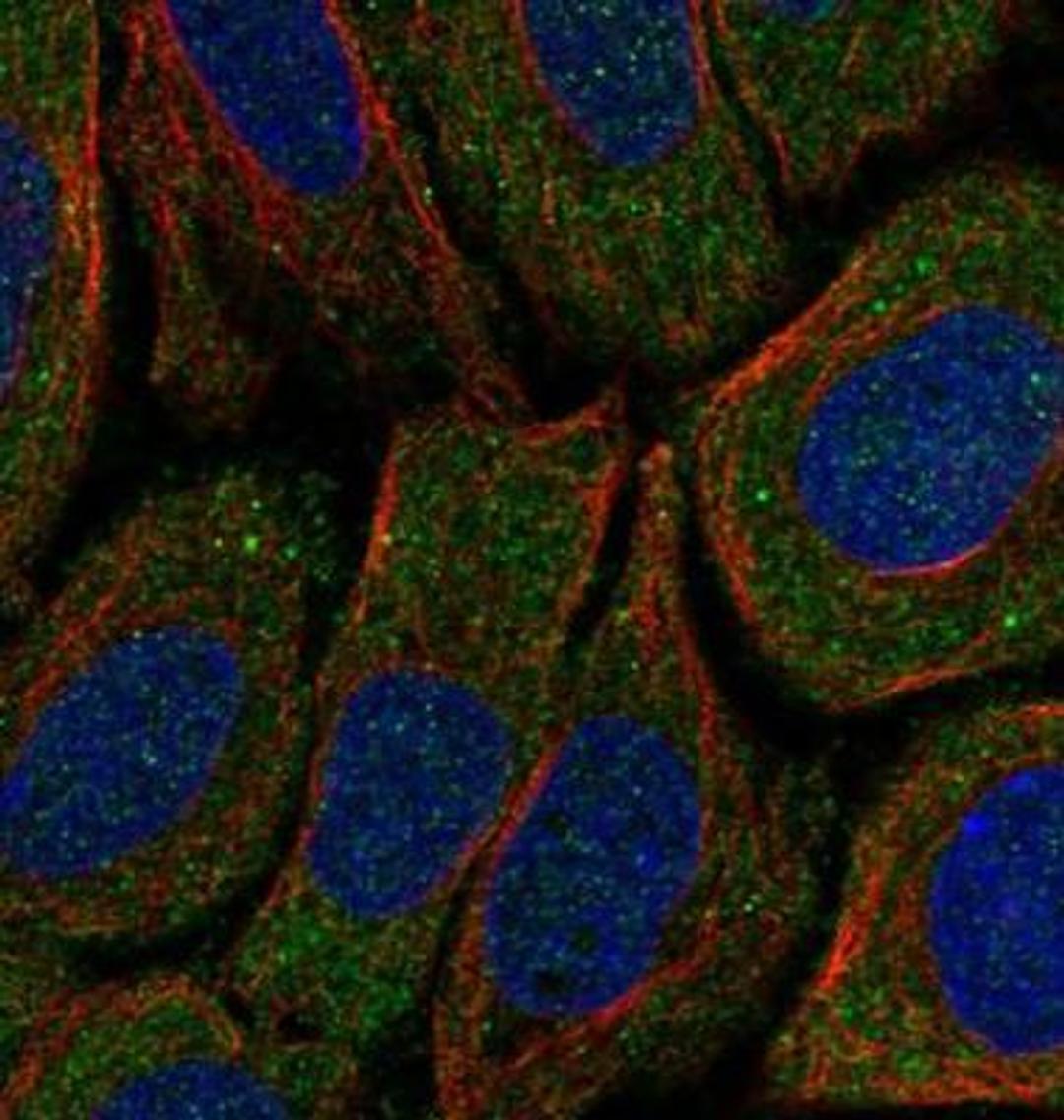 Immunocytochemistry/Immunofluorescence: CNOT1 Antibody [NBP2-31892] - Staining of human cell line SiHa shows positivity in cytoplasm & vesicles. Antibody staining is shown in green.