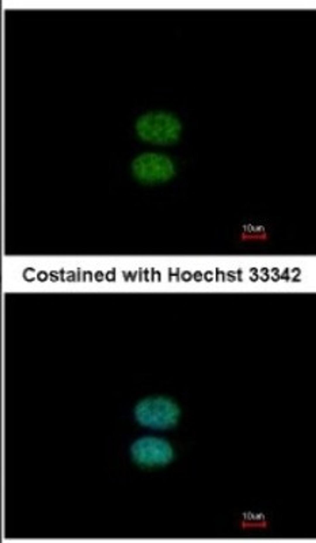 Immunocytochemistry/Immunofluorescence: EFHC2 Antibody [NBP2-16279] - Analysis of paraformaldehyde-fixed MCF-7, using antibody at 1:500 dilution.