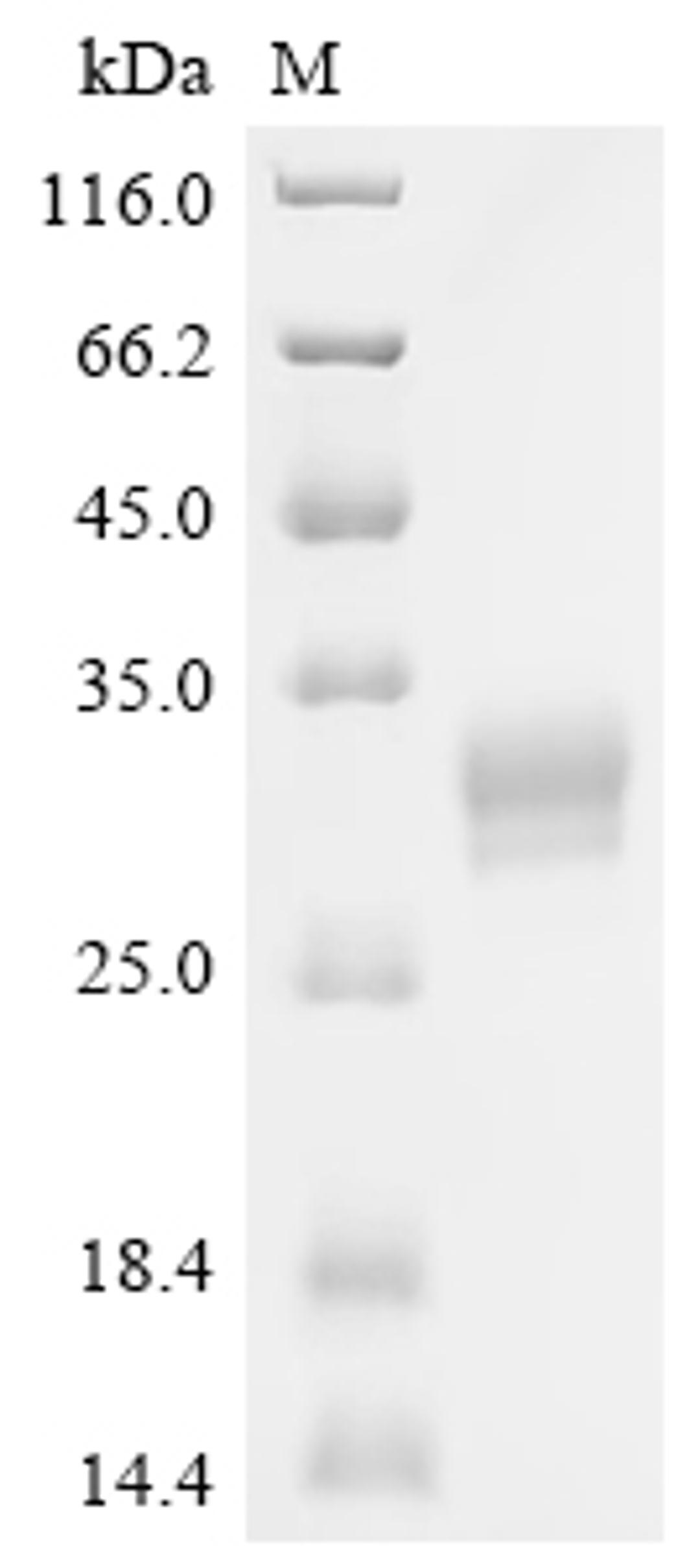 (Tris-Glycine gel) Discontinuous SDS-PAGE (reduced) with 5% enrichment gel and 15% separation gel.