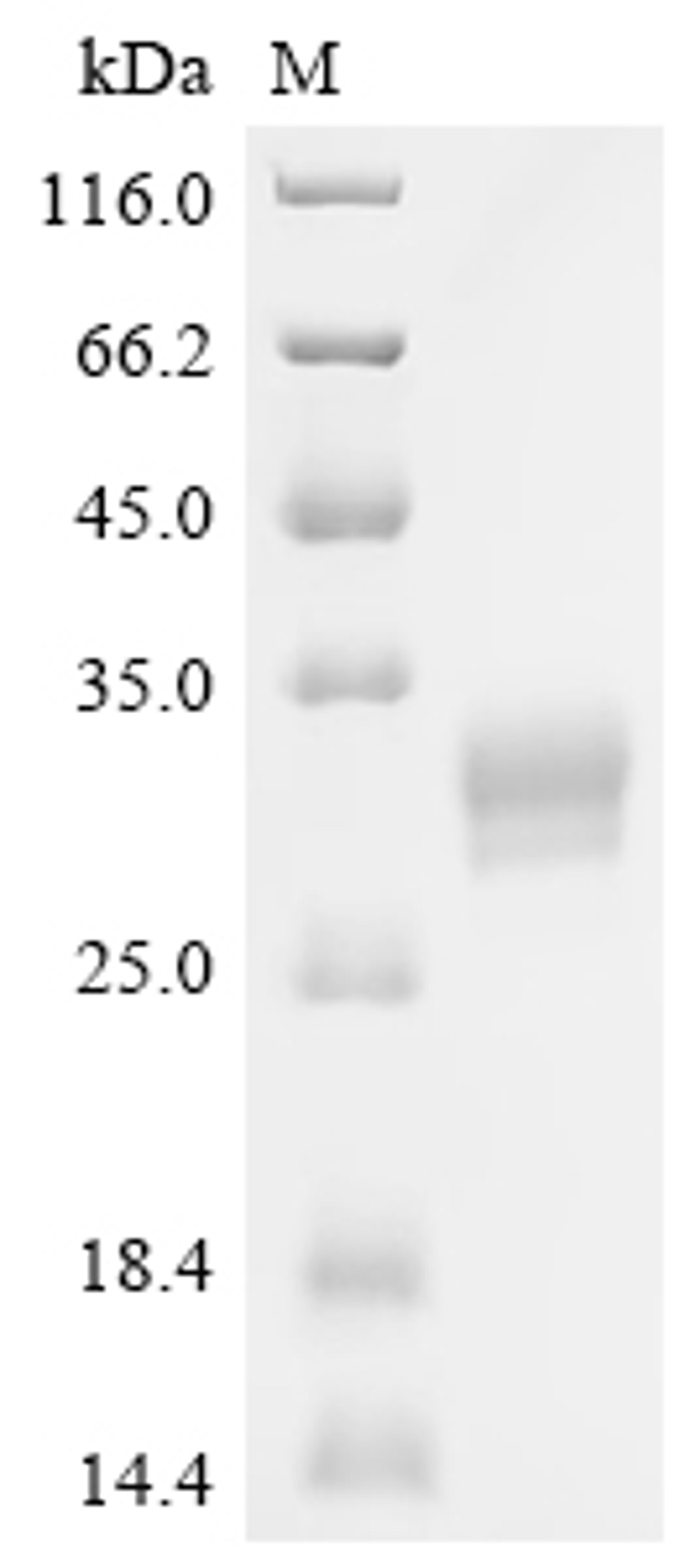 (Tris-Glycine gel) Discontinuous SDS-PAGE (reduced) with 5% enrichment gel and 15% separation gel.