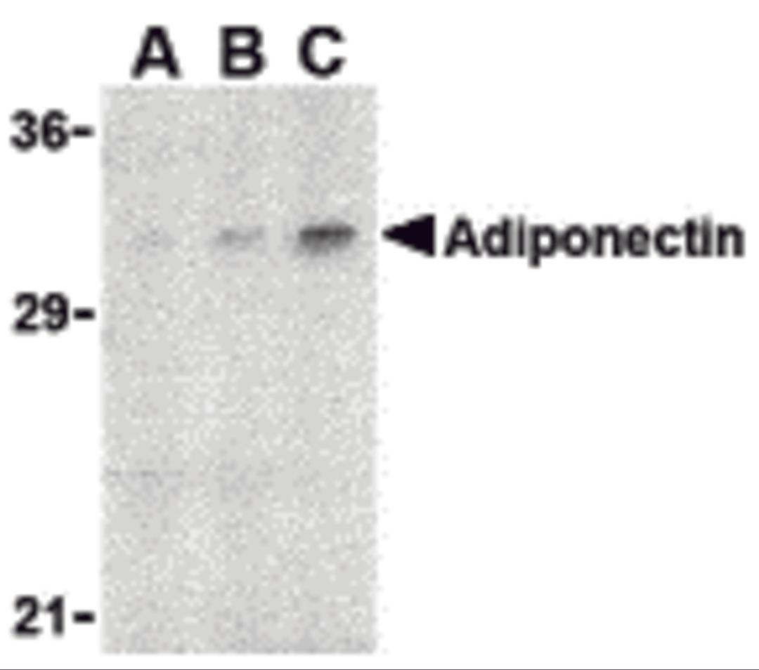 Western blot analysis of adiponectin in rat brain cell lysate with adiponectin antibody at (A) 1, (B) 2, and (C) 4 μg/mL.