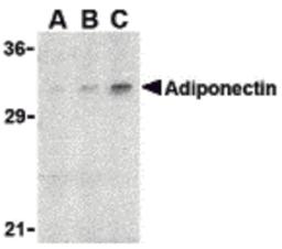 Western blot analysis of adiponectin in rat brain cell lysate with adiponectin antibody at (A) 1, (B) 2, and (C) 4 μg/mL.