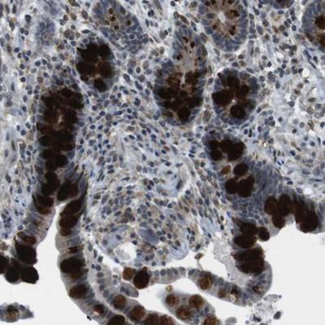 Immunohistochemistry: ST6GALNAC1 Antibody [NBP1-87043] - Staining of human colon shows strong cytoplasmic positivity in glandular cells.