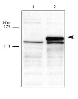 Western Blot: Dnmt3a Antibody [NB100-265] - Analysis using NB100-265 to detect overexpressed DNMT3A level in HCT-116 cells. Lane 1: 40 ug of nuclear extract from untreated HCT-116 cells. Lane 2: 40 ug of Nuclear extract from HCT-116 cells overexpressing DNMT3A.