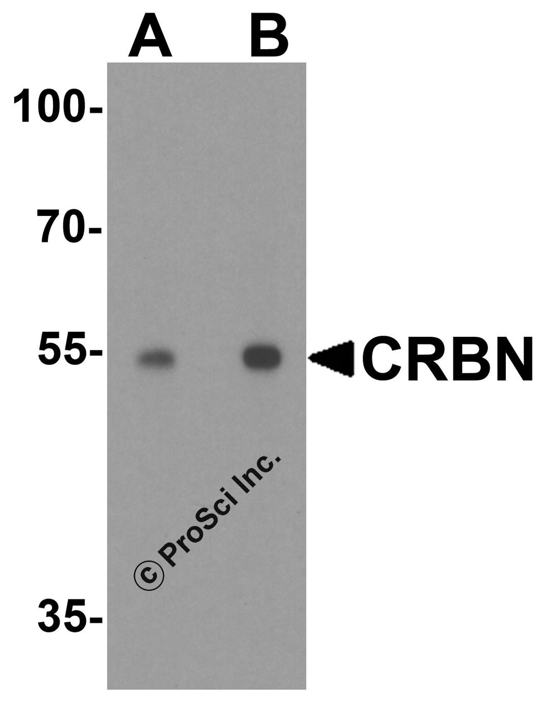 Western blot analysis of CRBN in human testis tissue lysate with CRBN antibody at (A) 0.5 and (B) 1 &#956;g/ml.