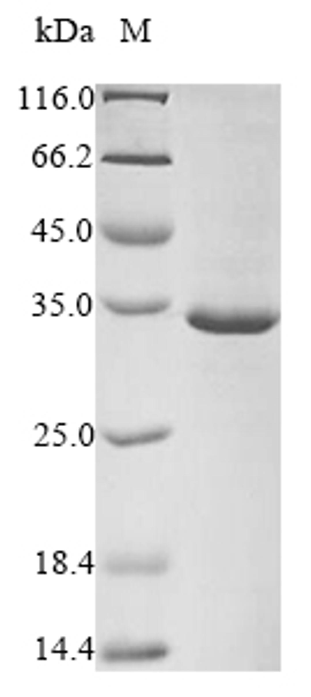 (Tris-Glycine gel) Discontinuous SDS-PAGE (reduced) with 5% enrichment gel and 15% separation gel.