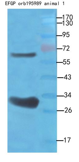 Western blot analysis of recombinant protein 100ng as lysate, use 1:500 dilution rate of using EGFP antibody
