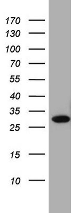 Western Blot: C14orf166B Antibody (2A4) [NBP2-46591] - Analysis of A549 cell lysate (35ug).