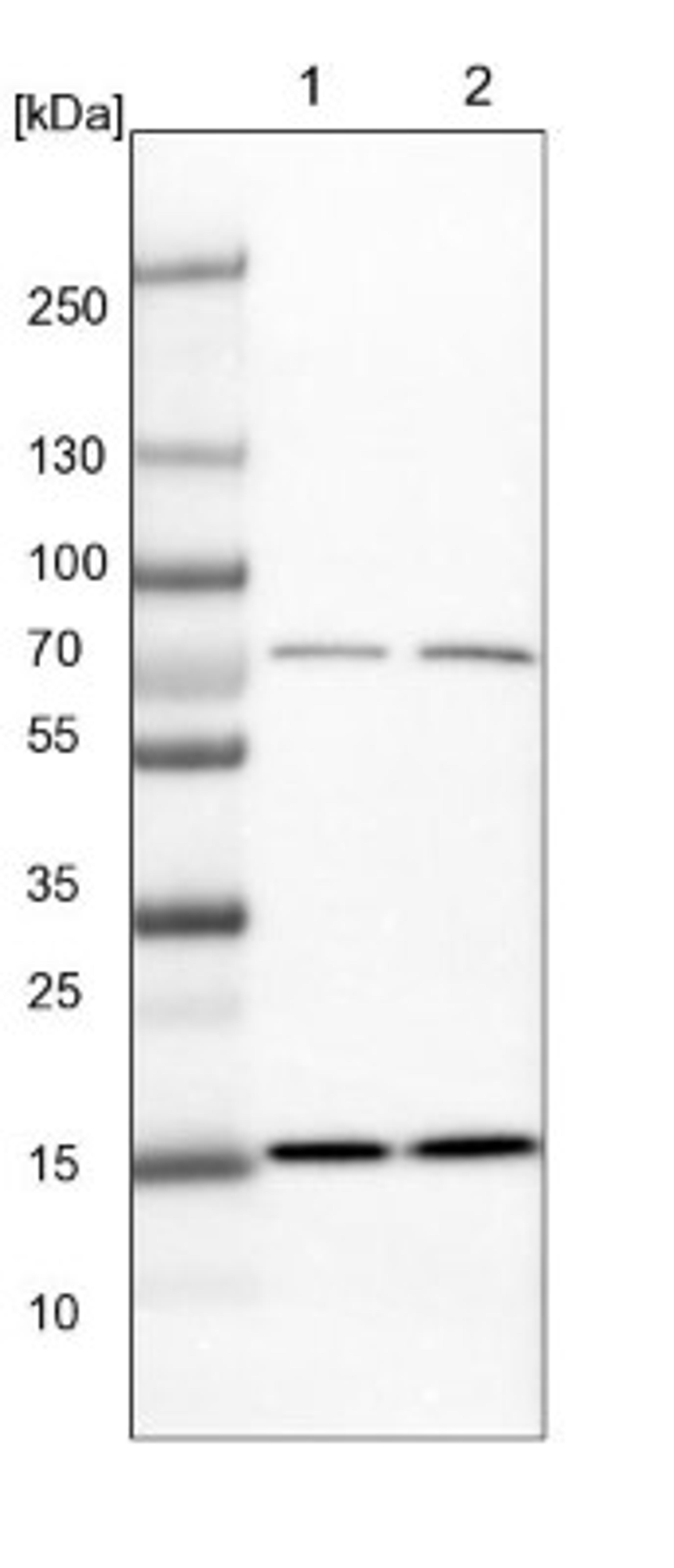 Western Blot: KLHL6 Antibody [NBP1-83880] - Lane 1: NIH-3T3 cell lysate (Mouse embryonic fibroblast cells)<br/>Lane 2: NBT-II cell lysate (Rat Wistar bladder tumour cells)