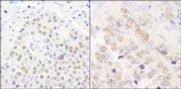 Detection of human and mouse CPSF100 by immunohistochemistry.